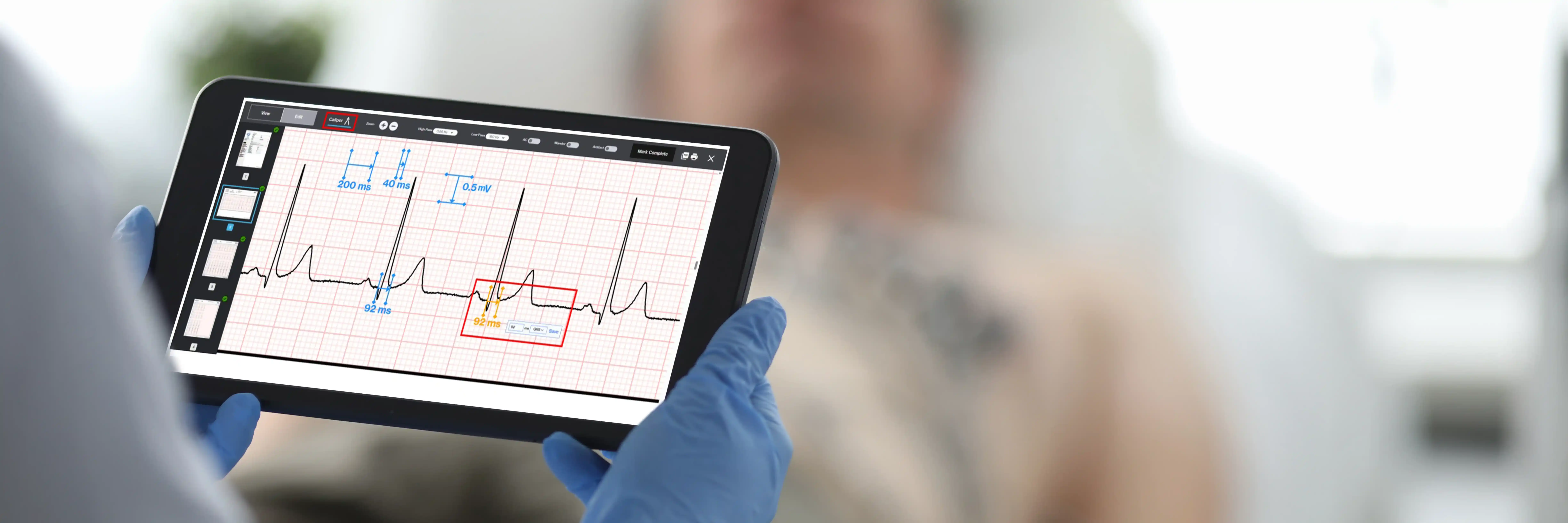 ECG Analysis on Tablet